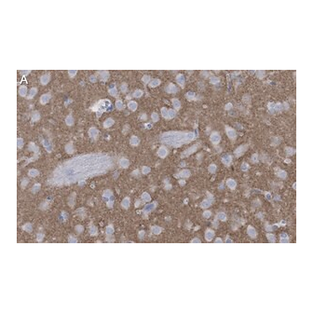 Merck Anti-mGluR5 Antibody, clone 1F11 ZooMAb Rabbit Monoclonal