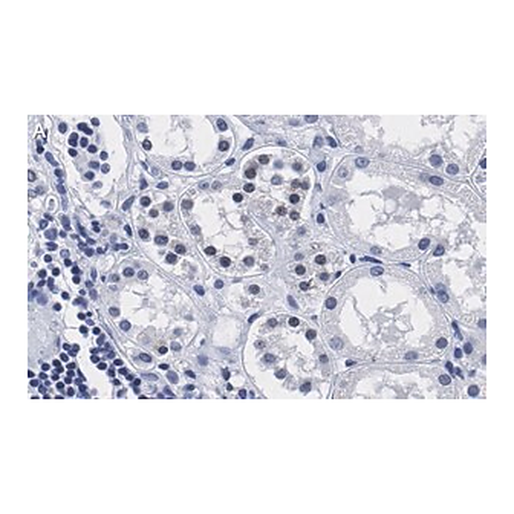 Merck Anti-PARP-1 Antibody, clone 12N17 Antibody, ZooMAb Rabbit Monoclonal