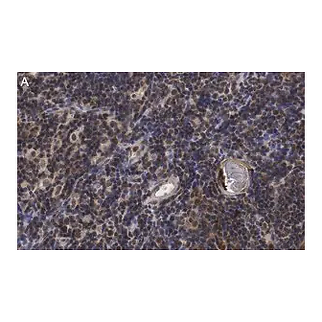Merck Anti-RORγ Antibody, clone 6F3.1 ZooMAb Mouse Monoclonal