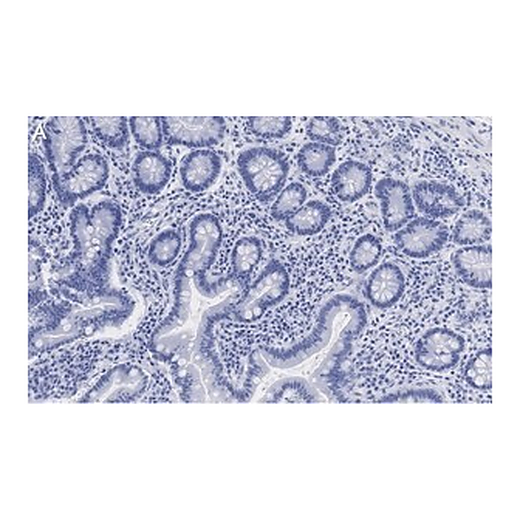 Merck Anti-Derlin-1 Antibody, clone 2C2, ZooMAb Rabbit Monoclonal