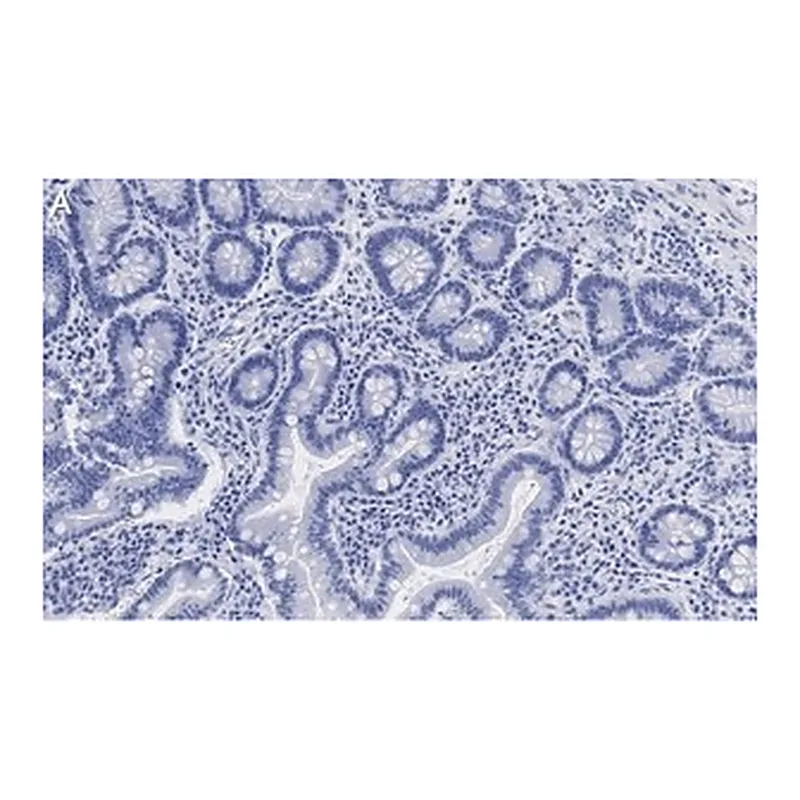 Merck Anti-Derlin-1 Antibody, clone 2C2, ZooMAb Rabbit Monoclonal