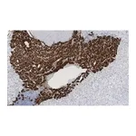 Merck Anti-Dopamine β Hydroxylase Antibody, clone 2B11 ZooMAb Rabbit Monoclonal