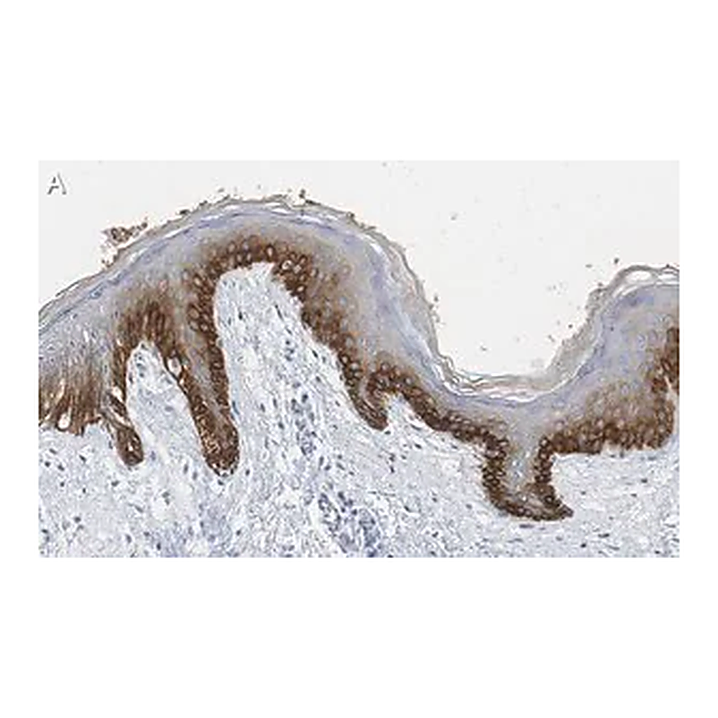 Merck Anti-pan-cytokeratin Antibody, clone AE1 ZooMAb Mouse Monoclonal