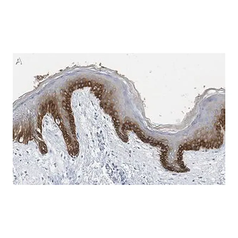 Merck Anti-pan-cytokeratin Antibody, clone AE1 ZooMAb Mouse Monoclonal
