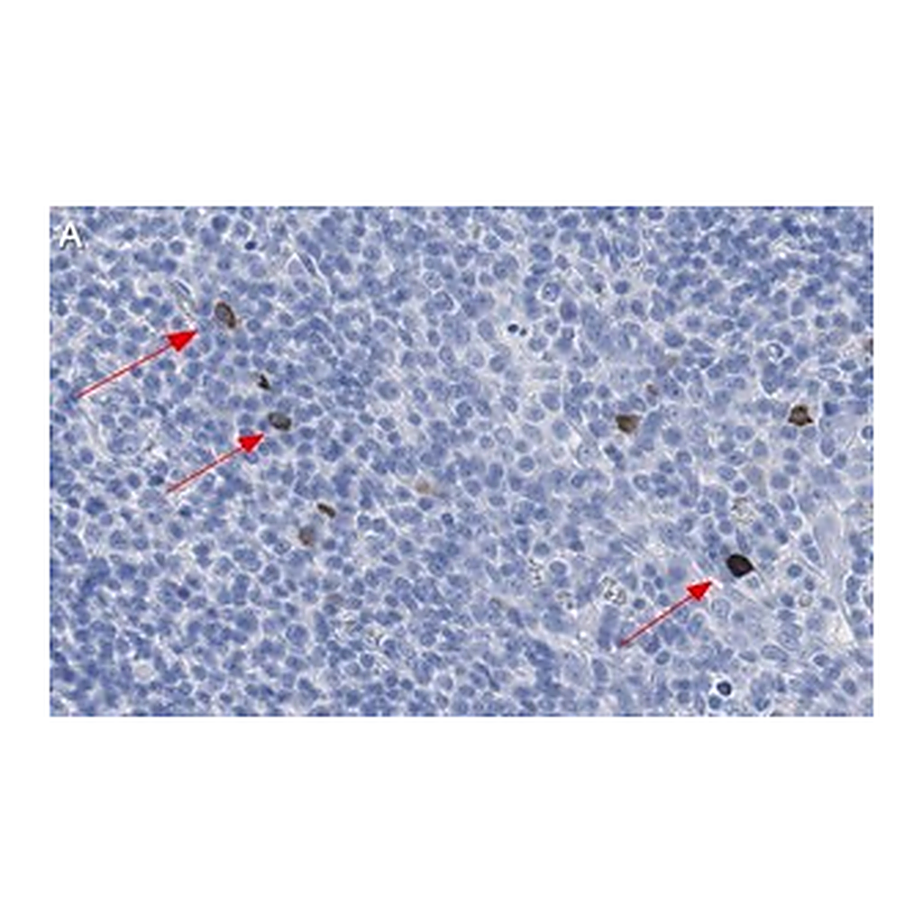 Merck Anti-TNFβ/LTA Antibody, clone 3B20-H2 ZooMAb Rabbit Monoclonal