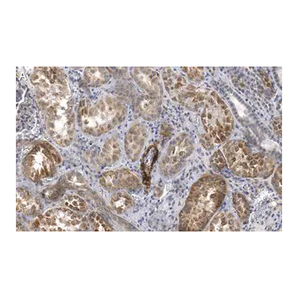 Merck Anti-Endoglin Antibody, clone 1I15 ZooMAb Rabbit Monoclonal