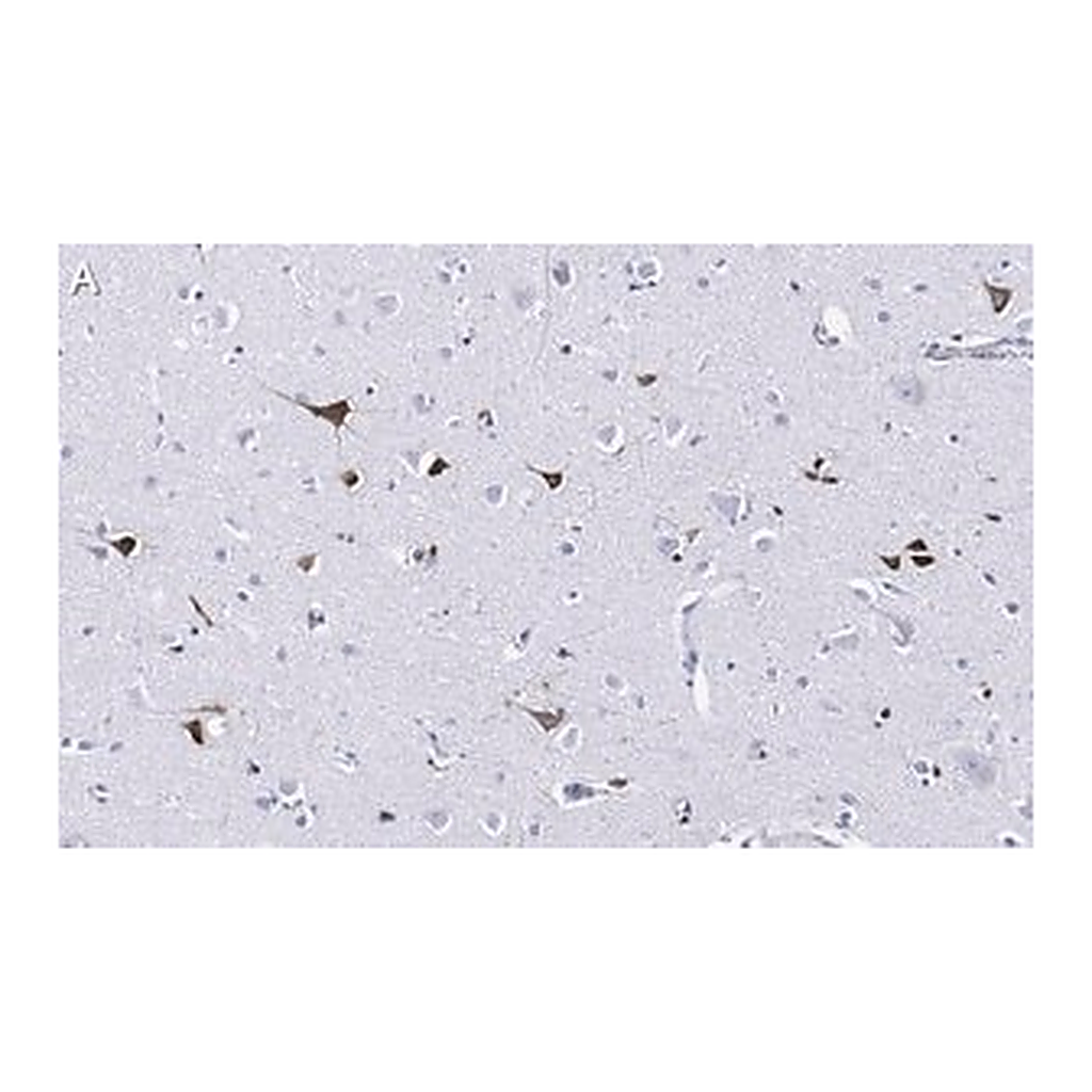 Merck Anti-Prion Protein Antibody, clone 3F17 ZooMAb Rabbit Monoclonal