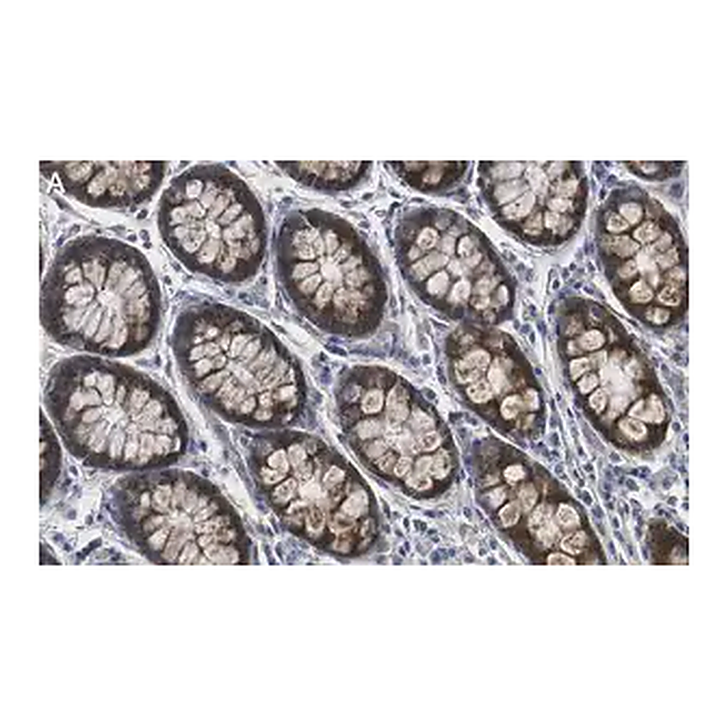 Merck Anti-MMP-14 Antibody, clone 1J5 ZooMAb Rabbit Monoclonal