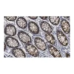 Merck Anti-MMP-14 Antibody, clone 1J5 ZooMAb Rabbit Monoclonal