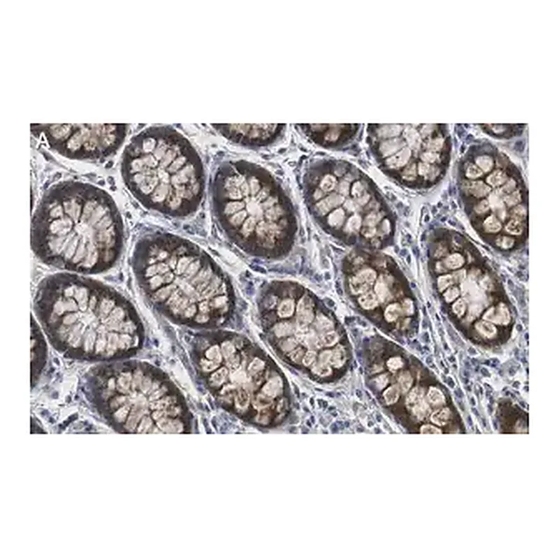 Merck Anti-MMP-14 Antibody, clone 1J5 ZooMAb Rabbit Monoclonal