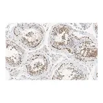 Merck Anti-MGMT Antibody, clone 2N19 ZooMAb Rabbit Monoclonal
