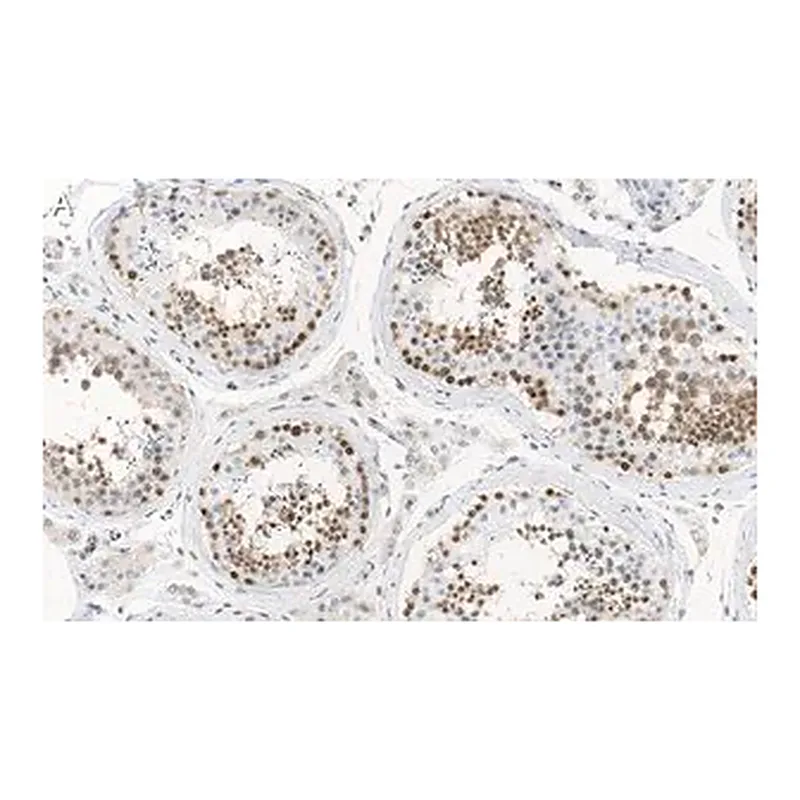 Merck Anti-MGMT Antibody, clone 2N19 ZooMAb Rabbit Monoclonal