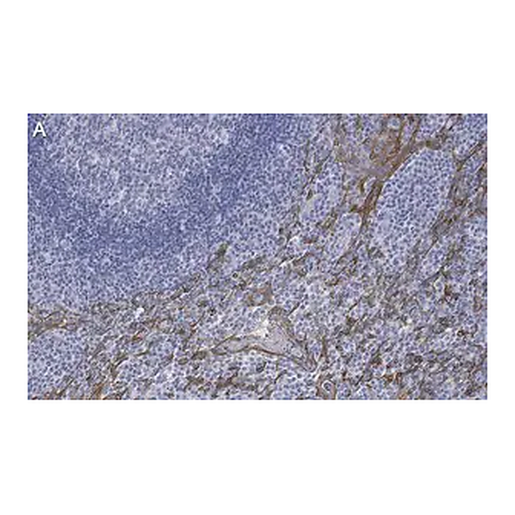 Merck Anti-Cytokeratin 5/6 Antibody, clone D5/16 B4 ZooMAb Mouse Monoclonal