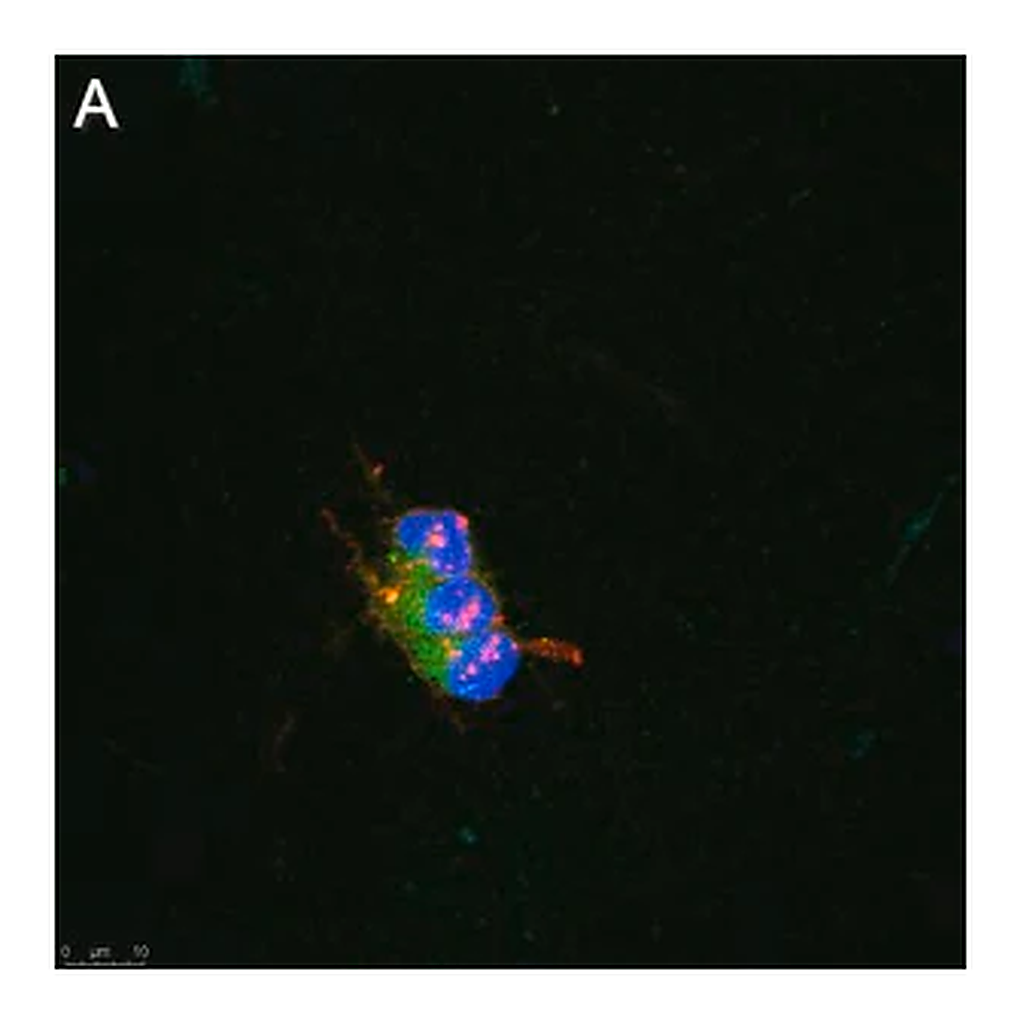 Merck Anti-pan-Na+ Channel Antibody, clone 4B8 ZooMAb Rabbit Monoclonal