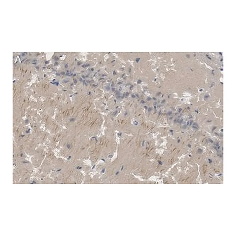 Merck Anti-PSD95 Antibody, clone K28/43 ZooMAb Mouse Monoclonal