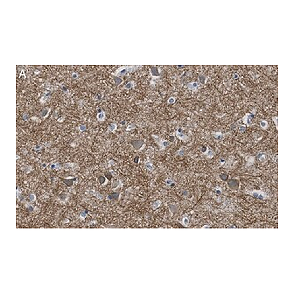 Merck Anti-K+/Cl- Cotransporter-2 Antibody, clone 5E13 ZooMAb Rabbit Monoclonal