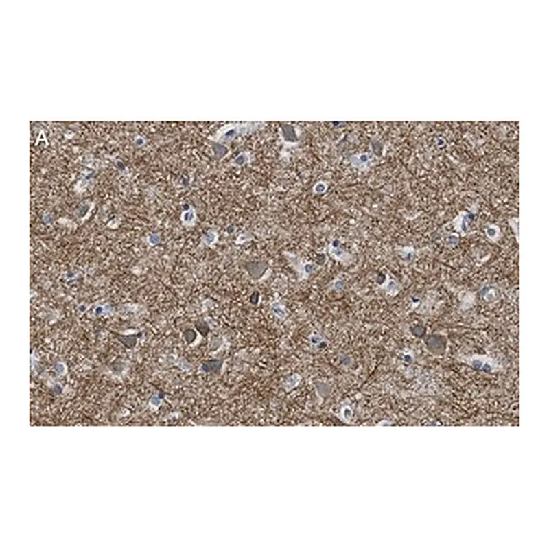 Merck Anti-K+/Cl- Cotransporter-2 Antibody, clone 5E13 ZooMAb Rabbit Monoclonal