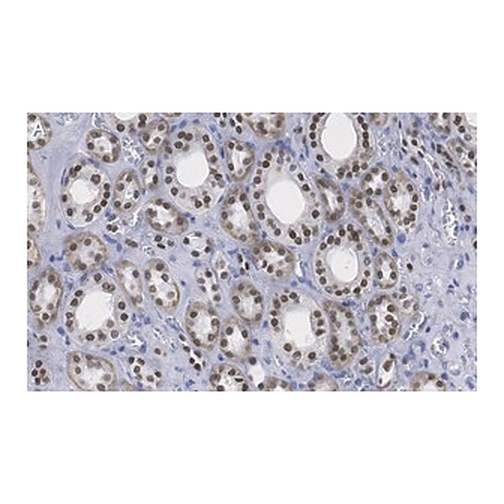 Merck Anti-HNF-1β Antibody, clone 1M22 ZooMAb Rabbit Monoclonal