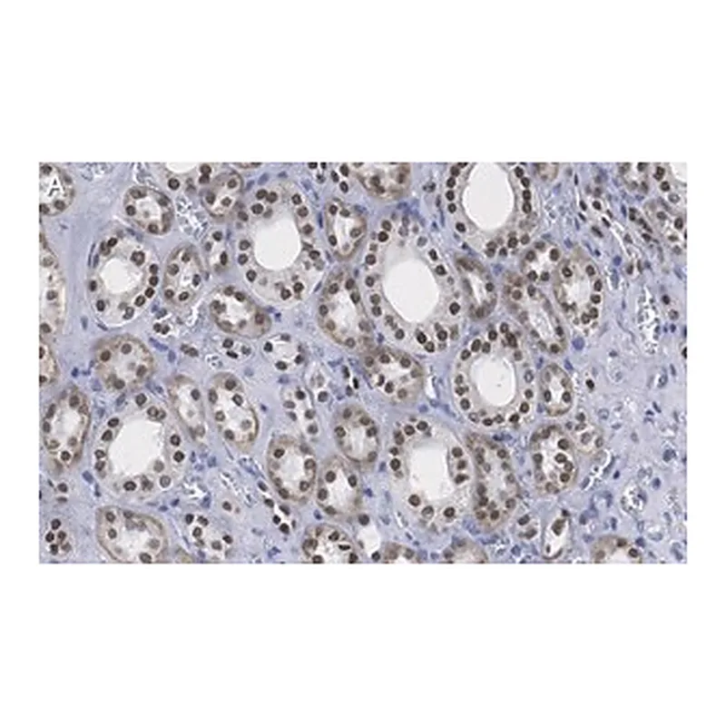 Merck Anti-HNF-1β Antibody, clone 1M22 ZooMAb Rabbit Monoclonal