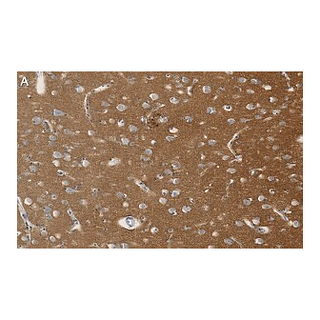 Merck Anti-SNAP-25 Antibody, clone 1J9 ZooMAb Rabbit Monoclonal