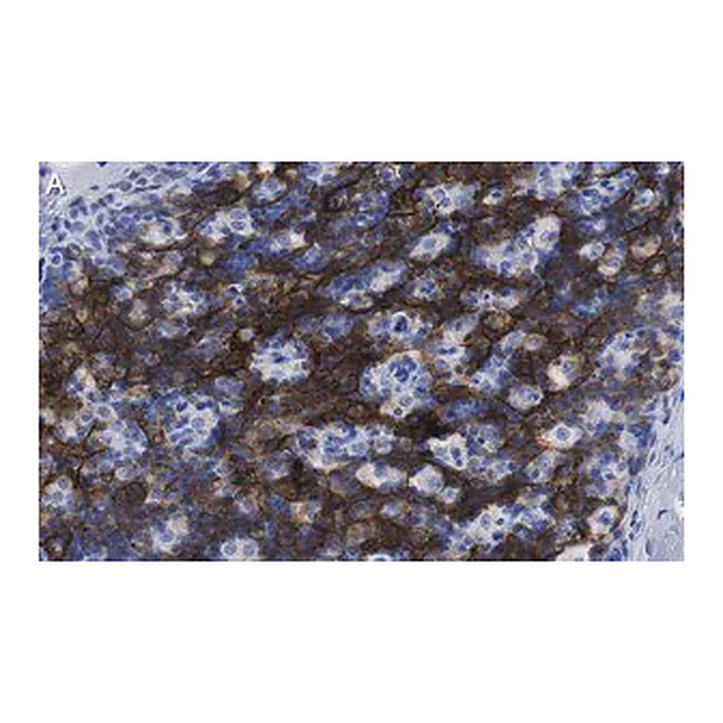 Merck Anti-CD8β Antibody, clone 1H21 ZooMAb Rabbit Monoclonal