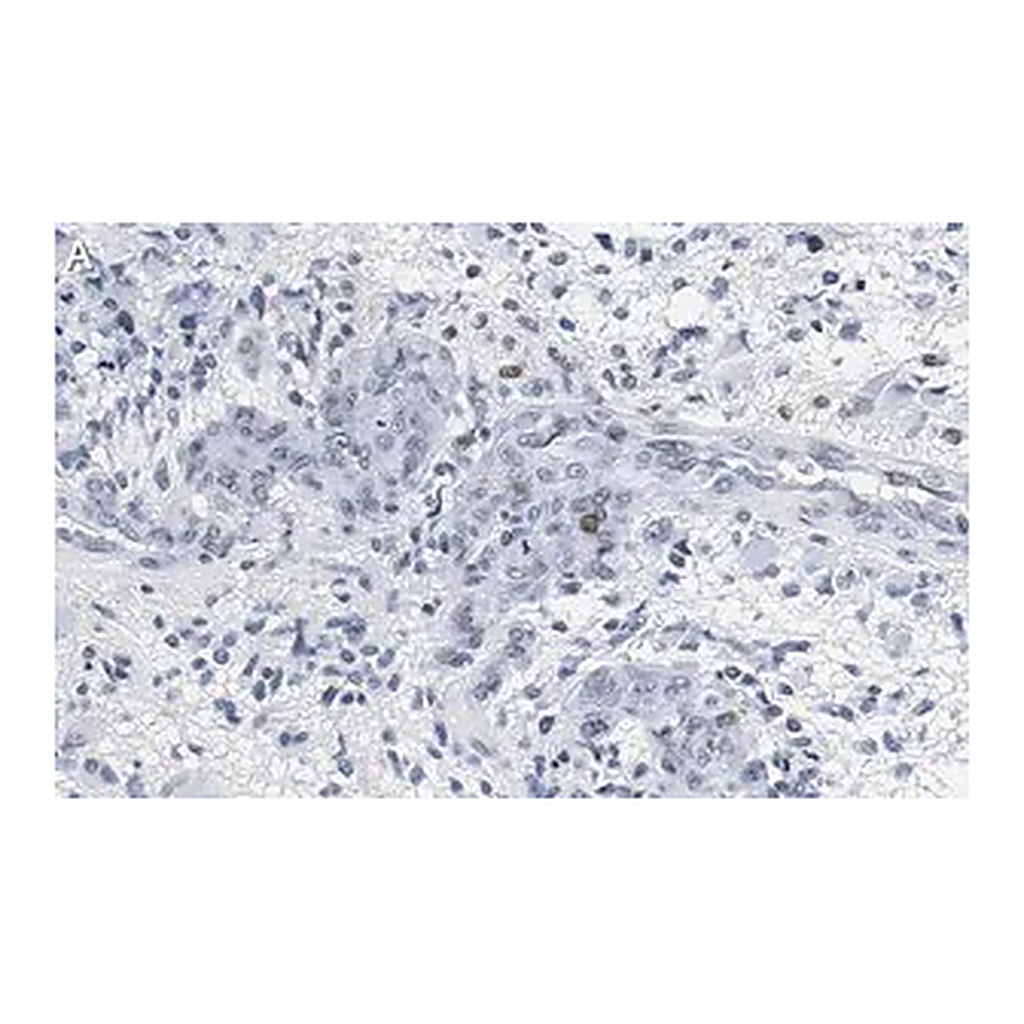 Merck Anti-p-PTEN (Tyr240) Antibody, clone 3G6 ZooMAb Rabbit Monoclonal