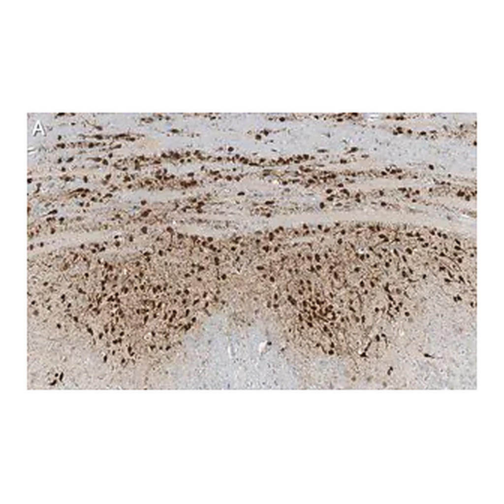 Merck Anti-Calretinin Antibody, clone 6B8.2 ZooMAb Mouse Monoclonal