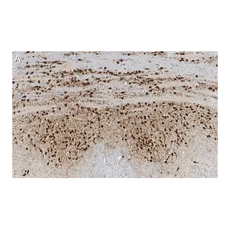 Merck Anti-Calretinin Antibody, clone 6B8.2 ZooMAb Mouse Monoclonal