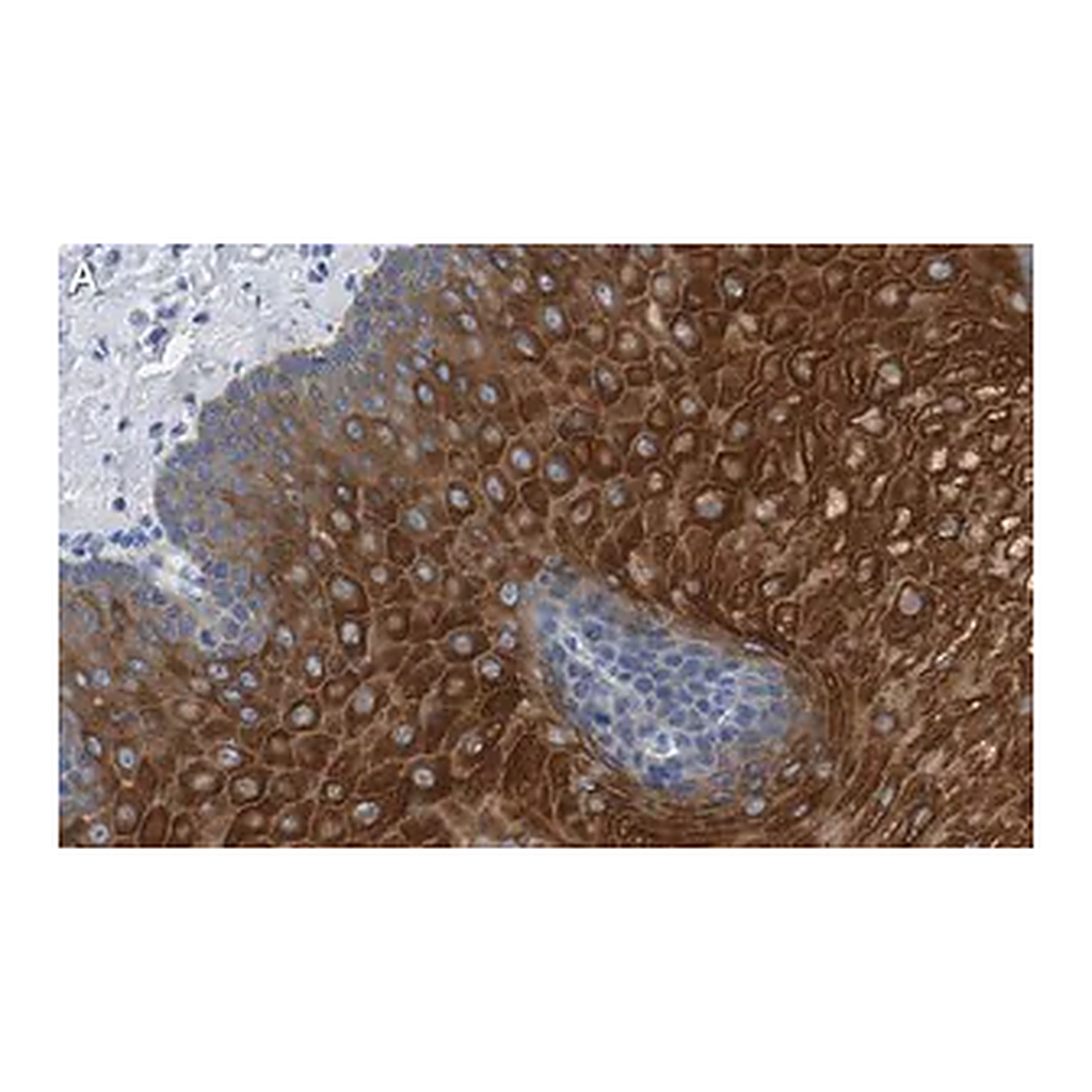 Merck Anti-Involucrin Antibody, clone 1D13 ZooMAb Rabbit Monoclonal