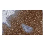 Merck Anti-Involucrin Antibody, clone 1D13 ZooMAb Rabbit Monoclonal