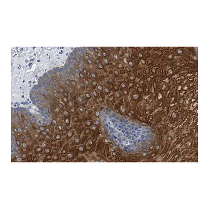 Merck Anti-Involucrin Antibody, clone 1D13 ZooMAb Rabbit Monoclonal