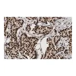 Merck Anti-53BP1 Antibody, clone BP13 ZooMAb Mouse Monoclonal