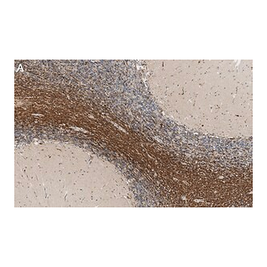 Merck Anti-Bin1 Antibody, clone 99D.2 ZooMAb Mouse Monoclonal