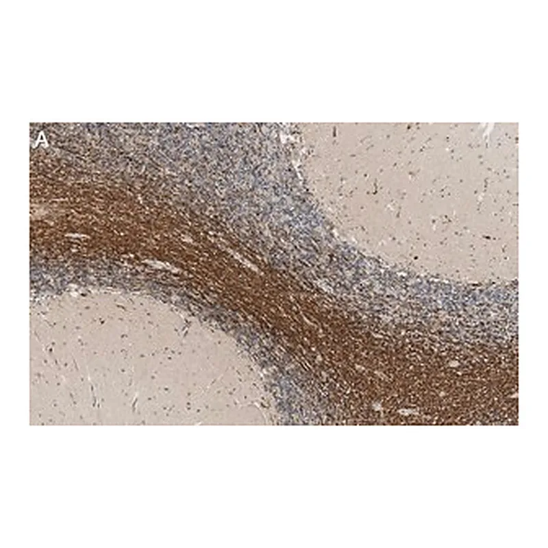 Merck Anti-Bin1 Antibody, clone 99D.2 ZooMAb Mouse Monoclonal