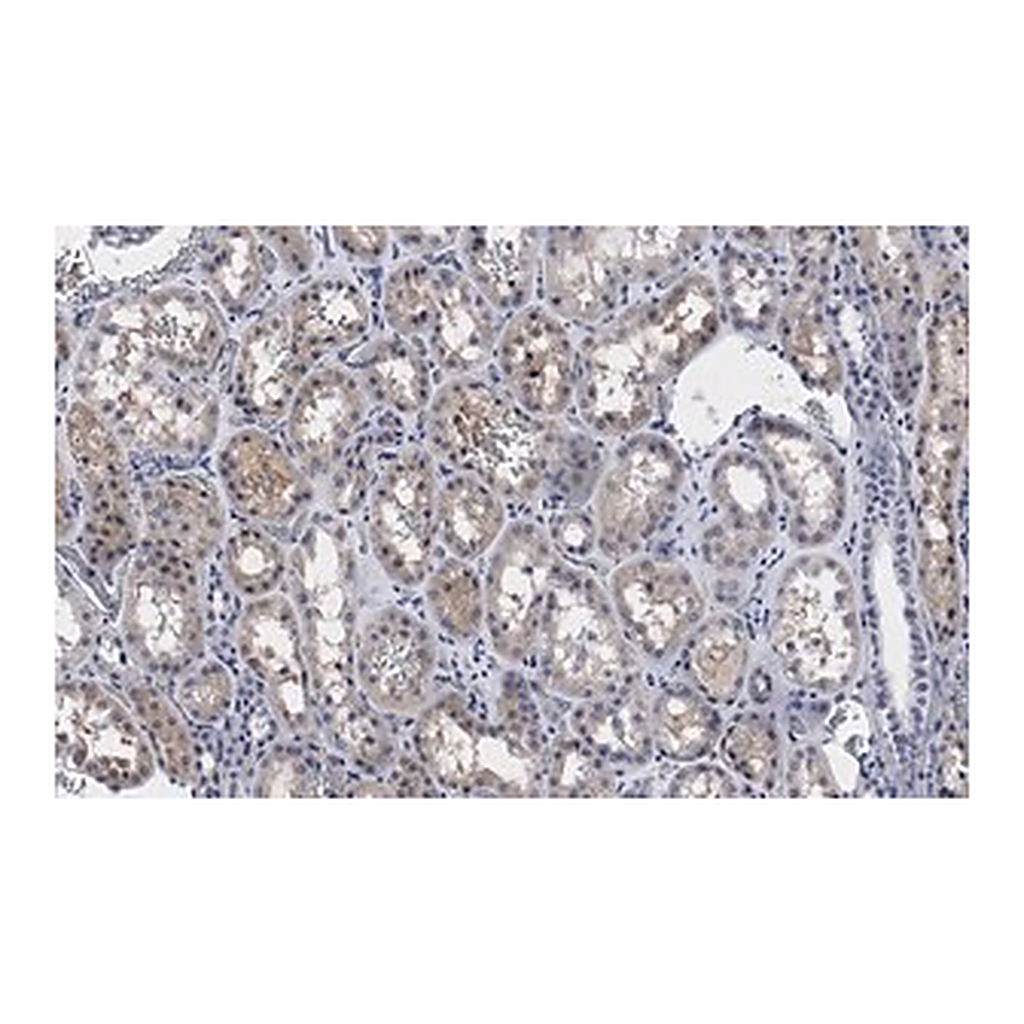 Merck Anti-PP2A C subunit Antibody, clone 2B15 ZooMAb Rabbit Monoclonal