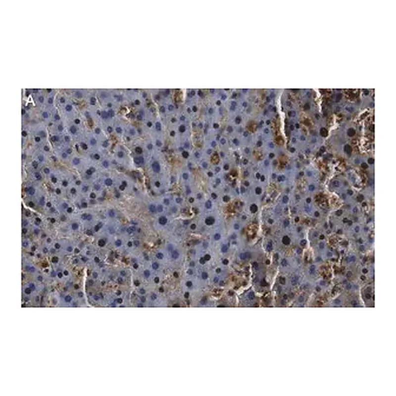 Merck Anti-Arginase-1 Antibody, clone 3B17 ZooMAb Rabbit Monoclonal