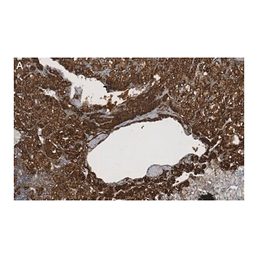 Merck Anti-Clusterin α chain Antibody, clone 41D ZooMAb Mouse Monoclonal