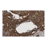 Merck Anti-Clusterin α chain Antibody, clone 41D ZooMAb Mouse Monoclonal