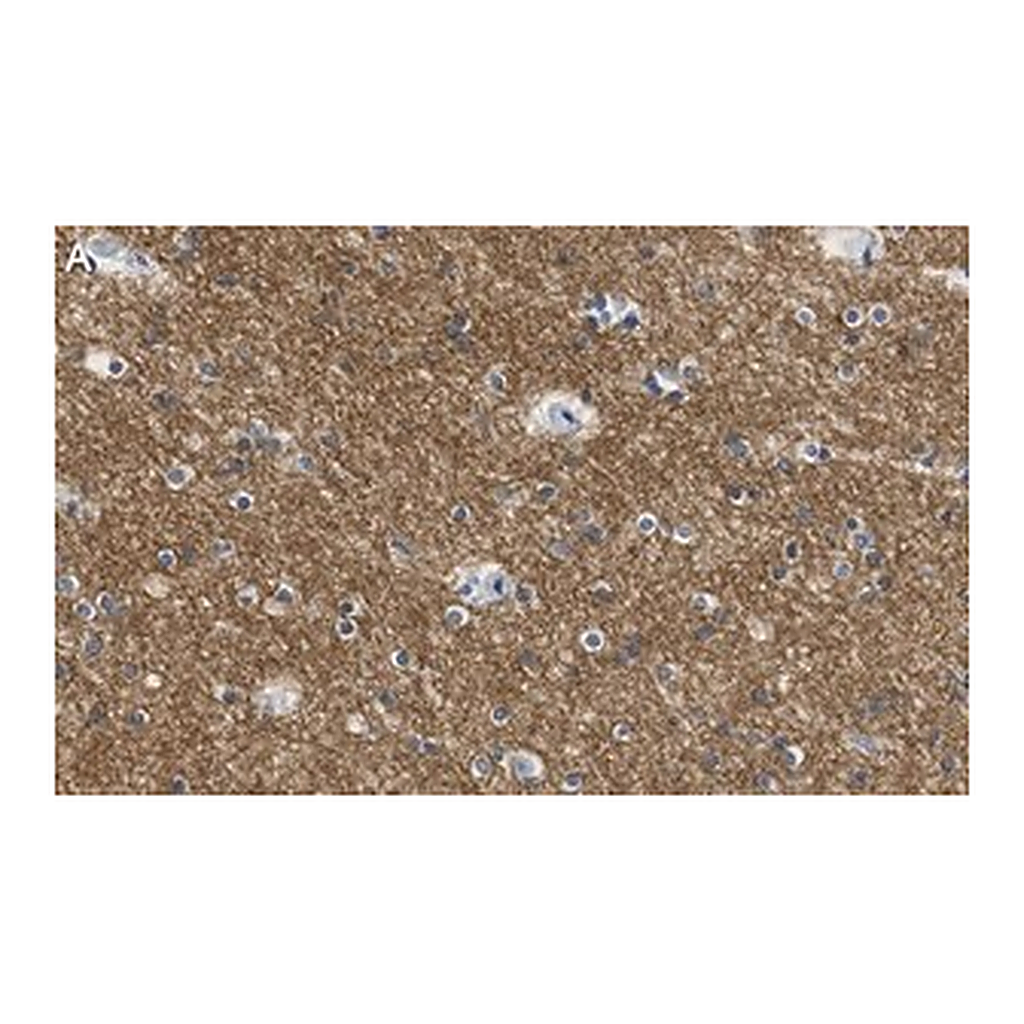 Merck Anti-KCNQ2 Antibody, clone 2G18 ZooMAb Rabbit Monoclonal