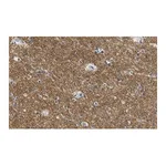 Merck Anti-KCNQ2 Antibody, clone 2G18 ZooMAb Rabbit Monoclonal