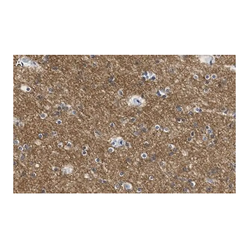 Merck Anti-KCNQ2 Antibody, clone 2G18 ZooMAb Rabbit Monoclonal