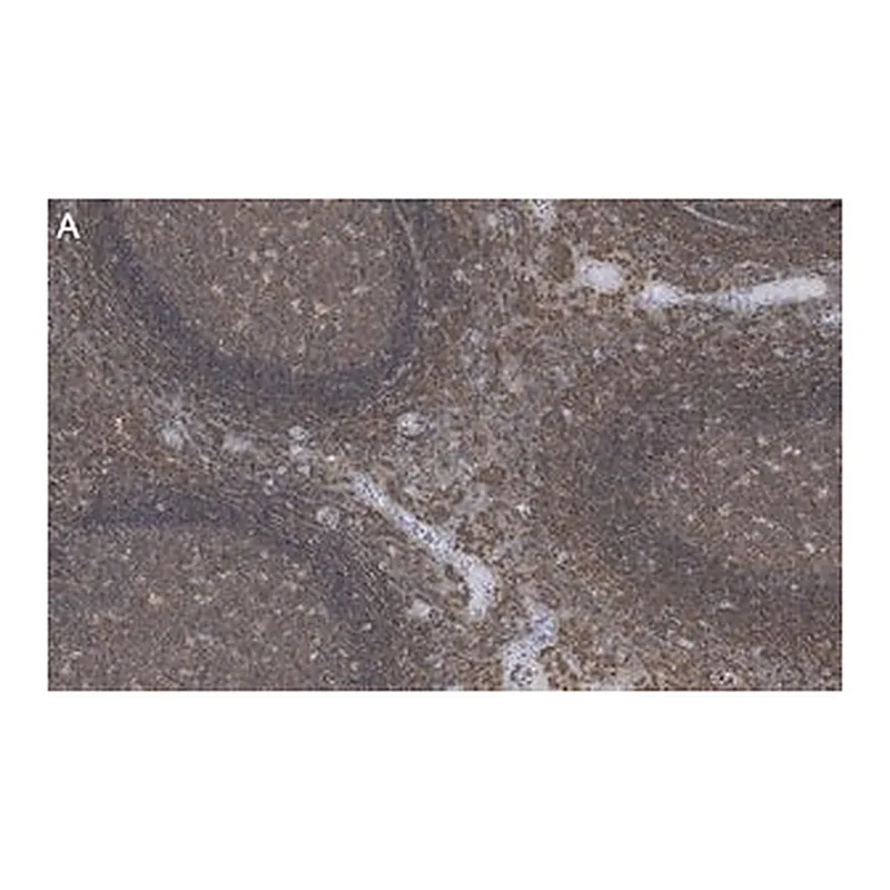 Merck Anti-Talin-1 Antibody, clone 2F8 ZooMAb Rabbit Monoclonal