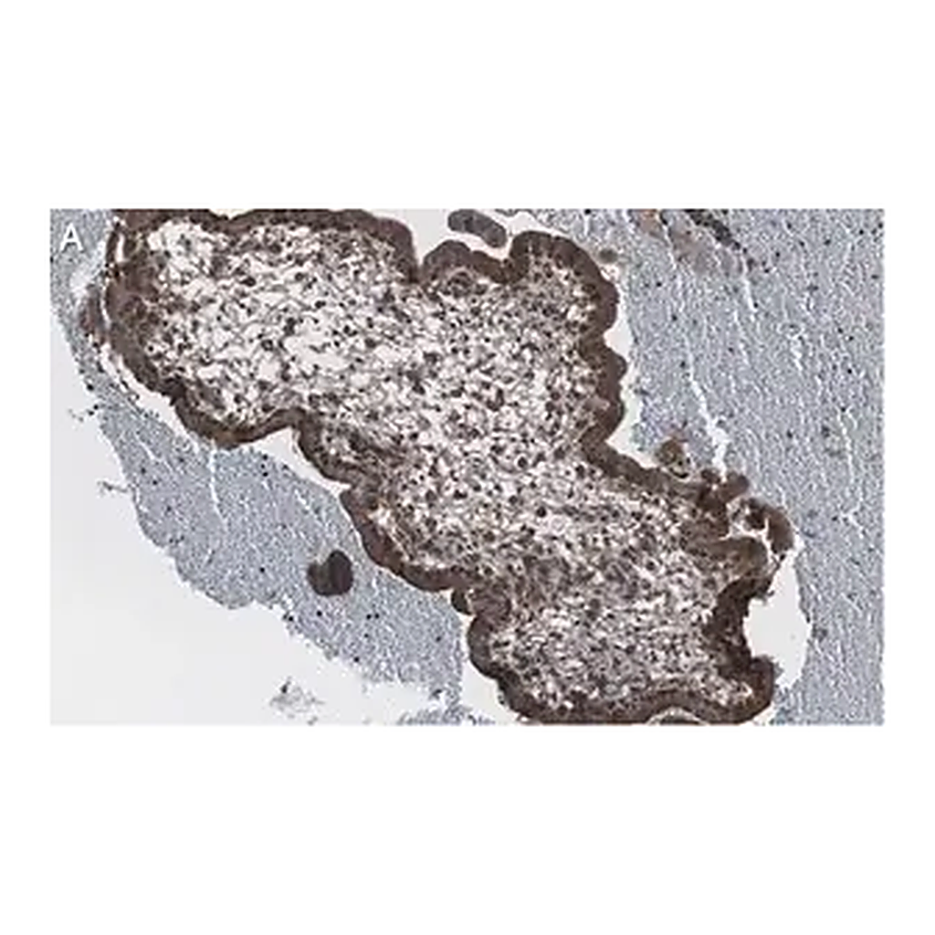 Merck Anti-NF-kB p65 subunit Antibody, clone 1D8 ZooMAb Rabbit Monoclonal