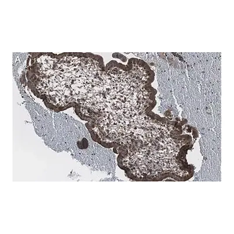 Merck Anti-NF-kB p65 subunit Antibody, clone 1D8 ZooMAb Rabbit Monoclonal