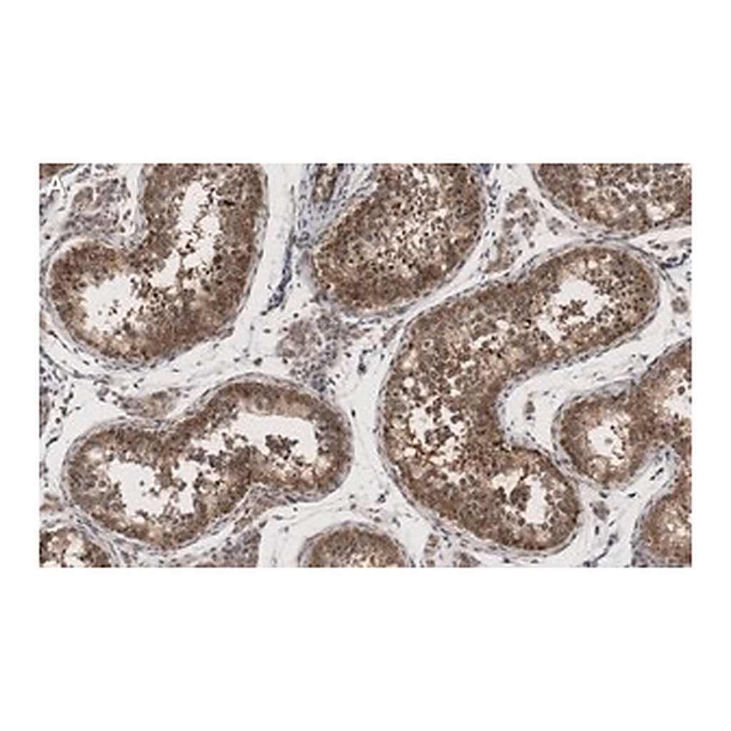 Merck Anti-METTL7A Antibody, clone 1O8 ZooMAb Rabbit Monoclonal