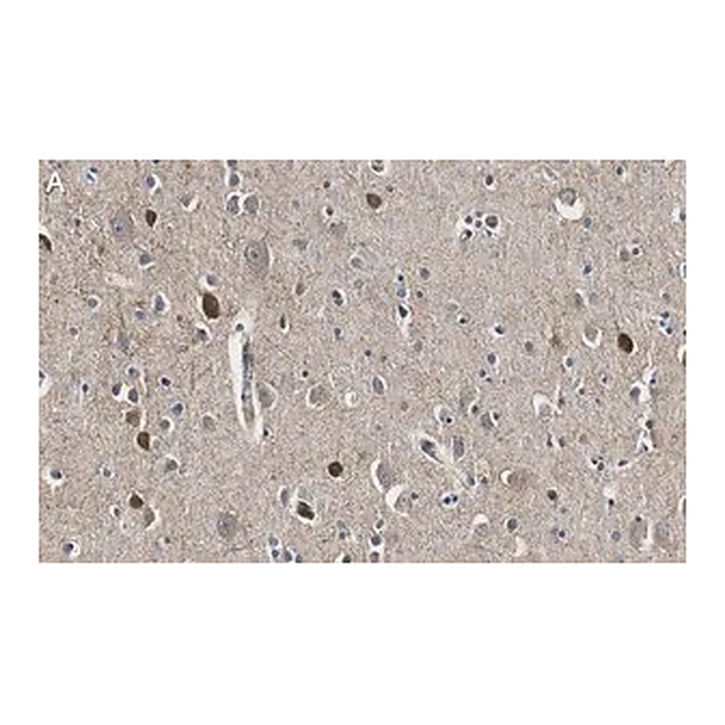 Merck Anti-GAD67 Antibody, clone 4B5 ZooMAb Rabbit Monoclonal