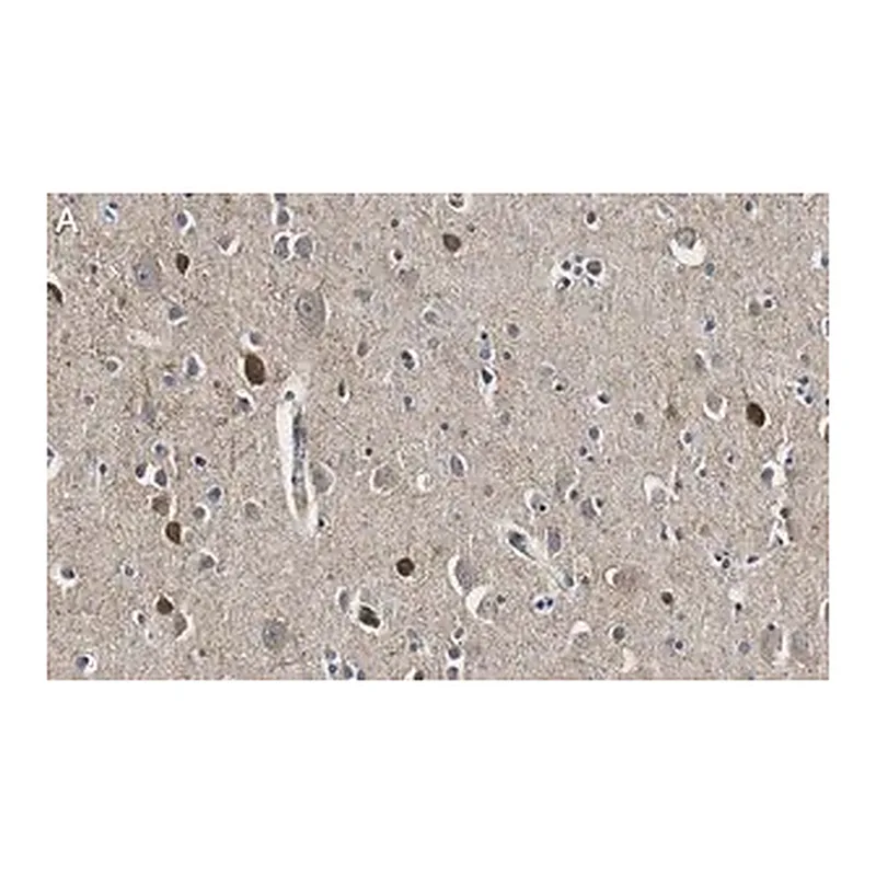 Merck Anti-GAD67 Antibody, clone 4B5 ZooMAb Rabbit Monoclonal