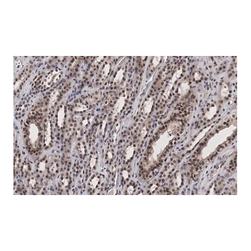 Merck Anti-MLL/HRX CT Antibody, clone 5C15 ZooMAb Rabbit Monoclonal
