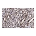 Merck Anti-MLL/HRX CT Antibody, clone 5C15 ZooMAb Rabbit Monoclonal