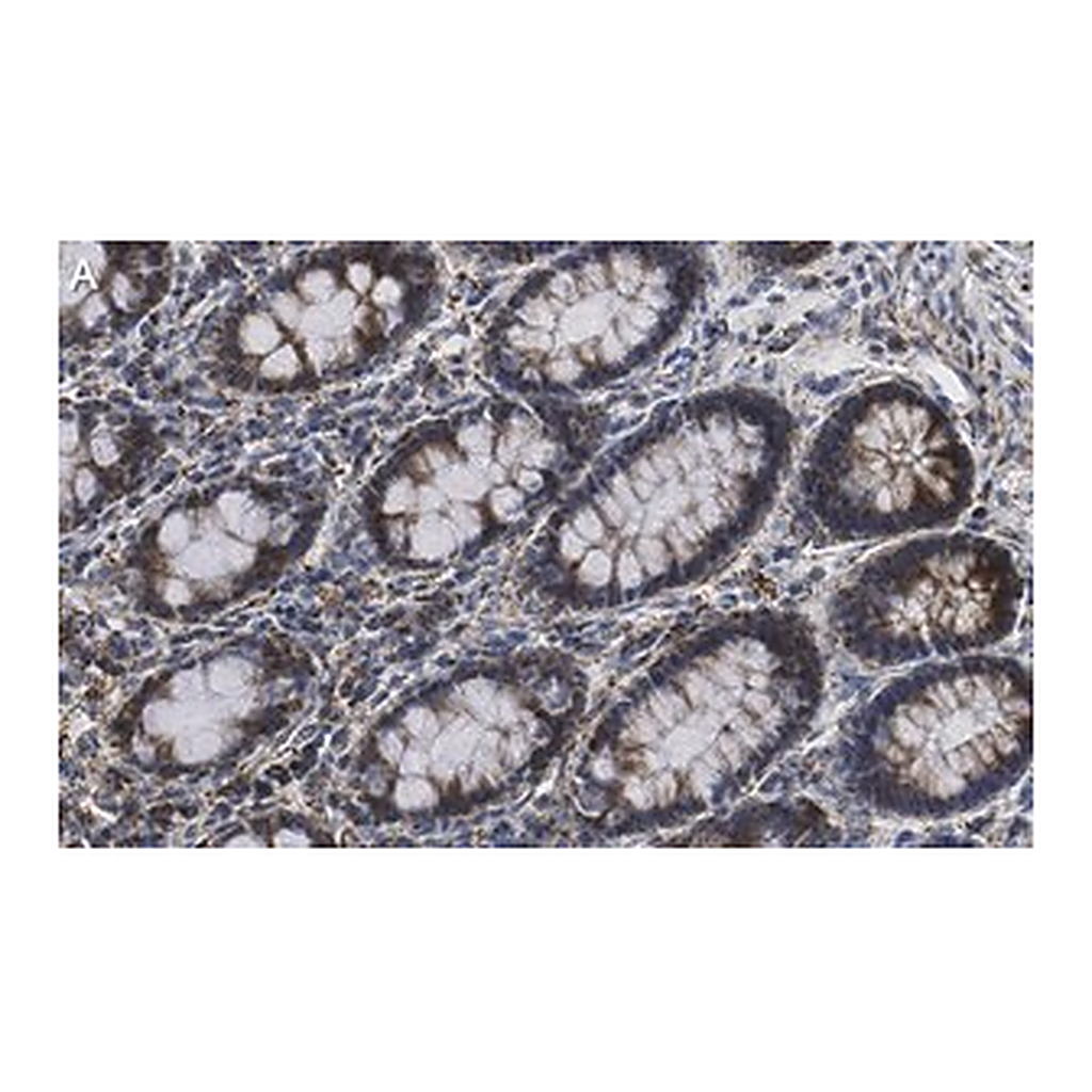 Merck Anti-Mn-SOD Antibody, clone 1C14 ZooMAb Rabbit Monoclonal